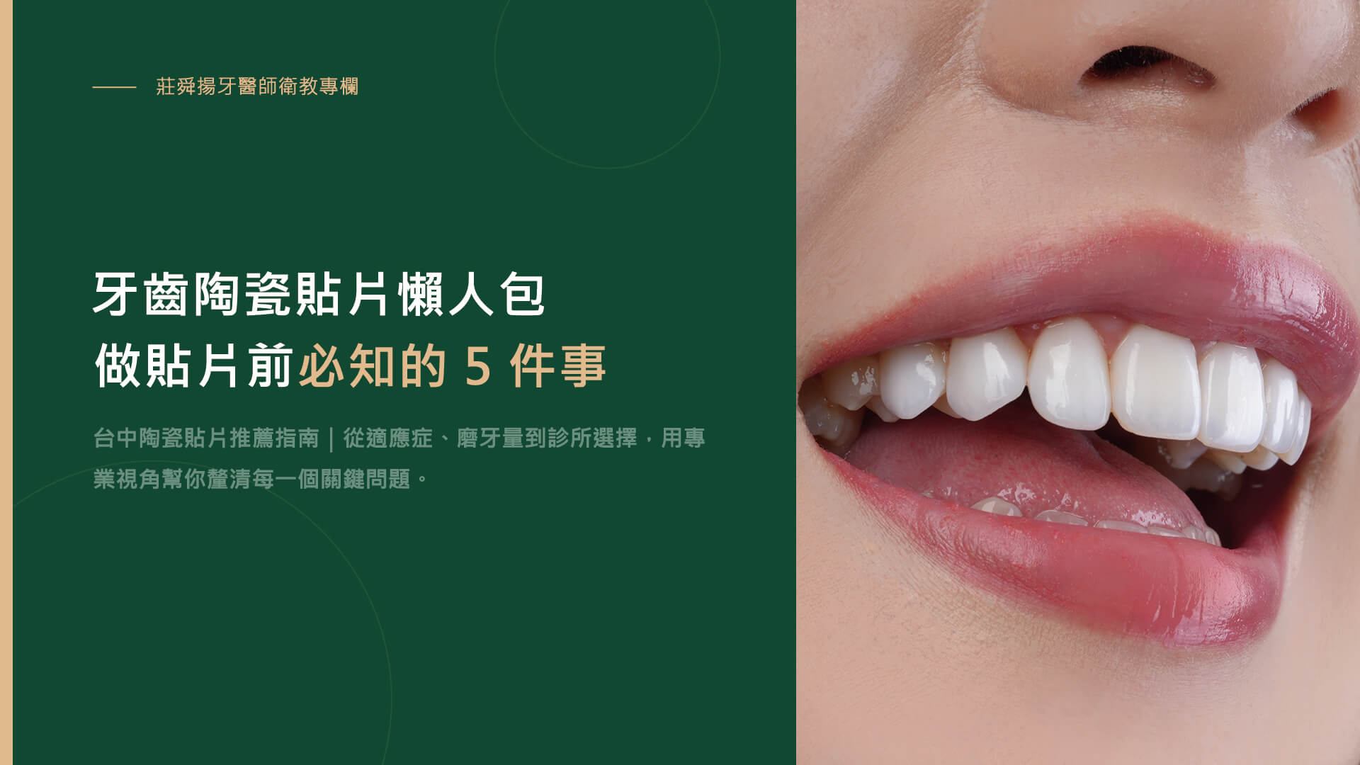 牙齒陶瓷貼片懶人包-做陶瓷貼片前，必須知道的5件事