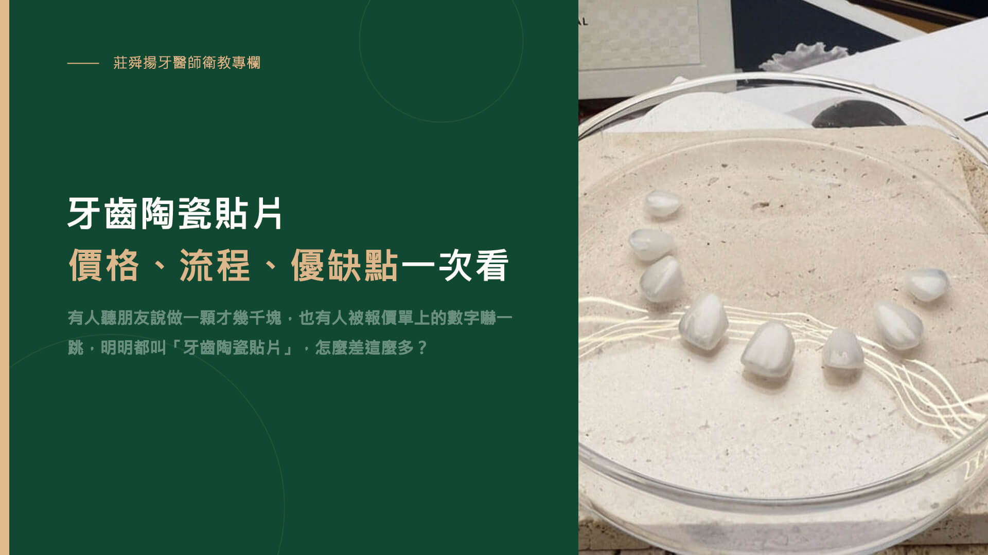 牙齒陶瓷貼片價格、流程、優缺點一次看